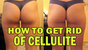 How To Get Rid Of Cellulite