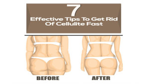 7 Effective Tips To Get Rid Of Cellulite Fast7 Effective Tips To Get Rid Of Cellulite Fast